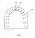 Fig. 09 - Treatment of teeth by aligners