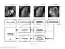 Fig. 03 - Unconstrained ear recognition using a combination of deep learning and handcrafted features