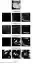 Fig. 08 - Unconstrained ear recognition using a combination of deep learning and handcrafted features