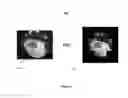 Fig. 07 - System and method for rectifying a wide-angle image
