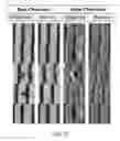 Fig. 06 - Semi-supervised anomaly detection in scanning electron microscope images
