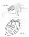 Fig. 04 - Inflatable exhibit of a human heart and method