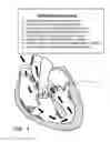 Fig. 07 - Inflatable exhibit of a human heart and method
