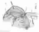 Fig. 05 - SURGICAL SIMULATION SYSTEMS, METHODS, AND COMPOSITIONS