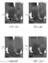 Fig. 07 - SURGICAL SIMULATION SYSTEMS, METHODS, AND COMPOSITIONS