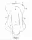 Fig. 06 - Penile prosthesis demonstration tool
