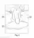 Fig. 09 - Penile prosthesis demonstration tool