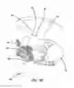 Fig. 06 - Simulated dissectible tissue