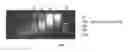 Fig. 11 - METHODS FOR FRAGMENTOME PROFILING OF CELL-FREE NUCLEIC ACIDS