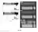 Fig. 34 - METHODS FOR FRAGMENTOME PROFILING OF CELL-FREE NUCLEIC ACIDS
