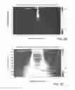 Fig. 09 - Method for fabricating superconducting devices using a focused ion beam