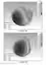 Fig. 17 - Multi-filtenna system