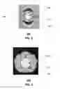 Fig. 03 - Flared dielectric coupling system and methods for use therewith
