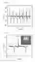 Fig. 17 - Paper-based triboelectric nanogenerator and method of manufacturing the same