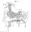 Fig. 02 - Implantable medical device