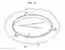 Fig. 07 - Implantable medical device