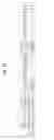 Fig. 25 - Method of transmitting and receiving downlink channel and apparatus therefor