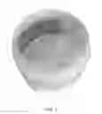 Fig. 03 - Molecular particle superior delivery system