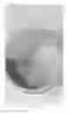 Fig. 04 - Molecular particle superior delivery system