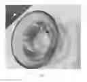 Fig. 08 - Molecular particle superior delivery system