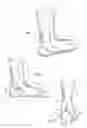 Fig. 02 - Sock with elastic heel