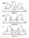 Fig. 02 - Pumping/nursing bra