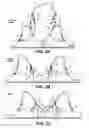 Fig. 04 - Pumping/nursing bra