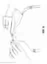 Fig. 10 - Pumping/nursing bra