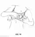 Fig. 11 - Pumping/nursing bra