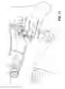 Fig. 12 - Pumping/nursing bra