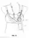 Fig. 18 - Pumping/nursing bra