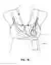 Fig. 20 - Pumping/nursing bra