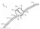 Fig. 01 - HEAD COVERING AND METHOD
