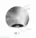 Fig. 07 - Cosmetic Applicator and Method