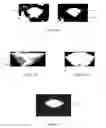 Fig. 18 - Systems and methods for virtual facial makeup removal and simulation, fast facial detection and landmark tracking, reduction in input video lag and shaking, and method for recommending makeup