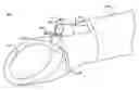 Fig. 01 - Sheath with detectable leader