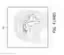 Fig. 09 - NEUROLOGICAL EXAMINATION SYSTEM