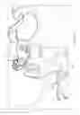 Fig. 09 - SINGLE POINT NON-OCCLUDING BLOOD PRESSURE SENSOR