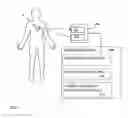 Fig. 02 - SYSTEM AND METHOD FOR REMOTE DETECTION OF CARDIAC CONDITION