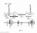 Fig. 04 - SYSTEM AND METHOD FOR REMOTE DETECTION OF CARDIAC CONDITION