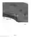 Fig. 06 - ELECTROENCEPHALOGRAPHY SENSORS
