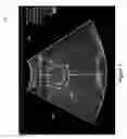 Fig. 02 - Predictive use of quantitative imaging