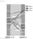 Fig. 06 - AIRWAY MUCUS IMPACTION
