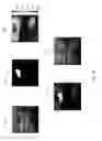 Fig. 09 - Assisted detection model of breast tumor, assisted detection system thereof, and method for assisted detecting breast tumor