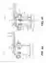 Fig. 28 - Surgical tensor where each distraction mechanism is supported and aligned by at least two guide shafts