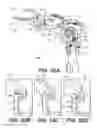 Fig. 40 - Surgical tensor where each distraction mechanism is supported and aligned by at least two guide shafts