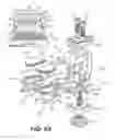 Fig. 45 - Surgical tensor where each distraction mechanism is supported and aligned by at least two guide shafts