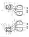 Fig. 46 - Surgical tensor where each distraction mechanism is supported and aligned by at least two guide shafts