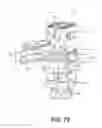 Fig. 49 - Surgical tensor where each distraction mechanism is supported and aligned by at least two guide shafts