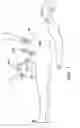 Fig. 02 - Trocar cannula assembly and method of manufacture